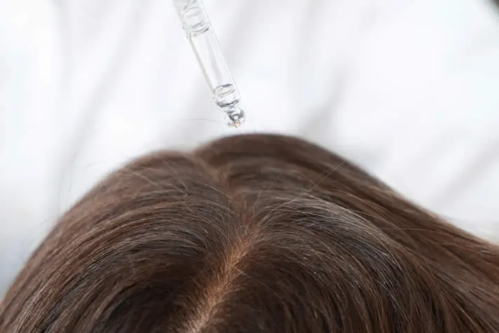 dermatologist-treating-lice